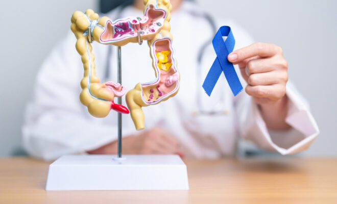 Phases of Stomach Cancer Disease