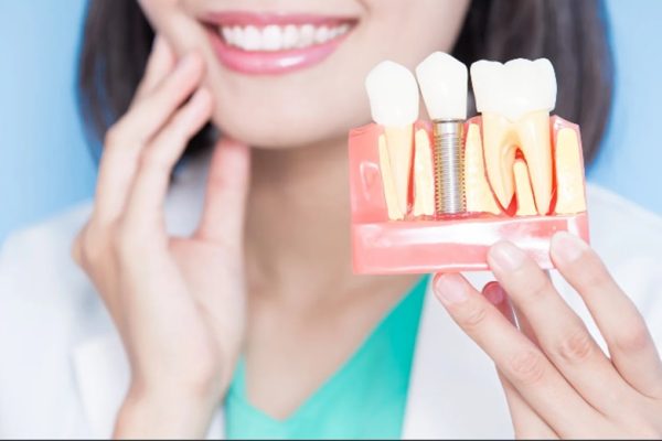 Dental Implants
